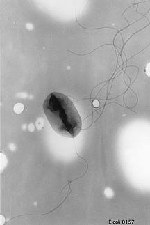 "E. coli 0157" Image from the Centers for Disease Control & Prevention