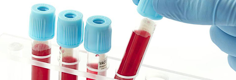 blood collection tubes in a laboratory